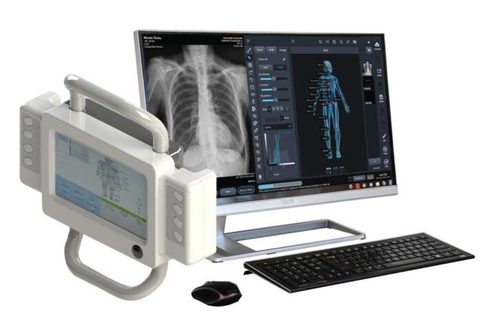 digital x-ray